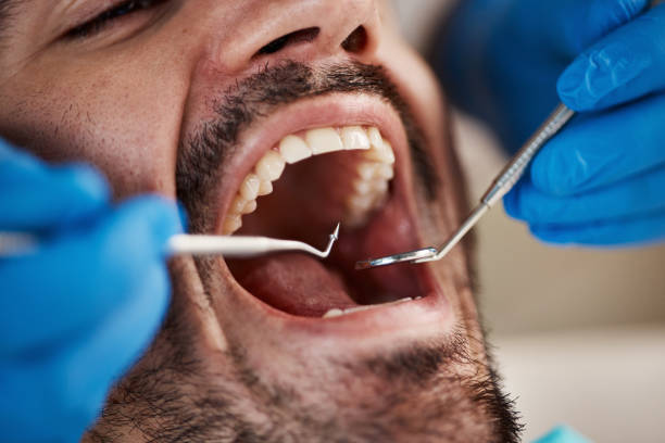 Best Mobile Emergency Dentist in Lake City, GA